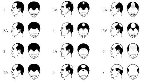 Hair loss treatment visual image